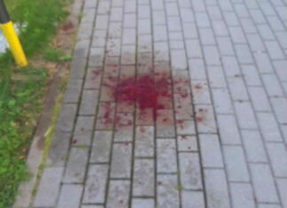 świeradów pobicie pogotowie policja napad rozbój 1