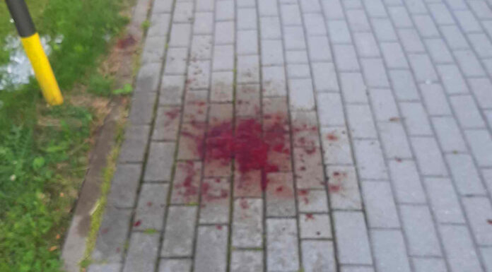 świeradów pobicie pogotowie policja napad rozbój 1