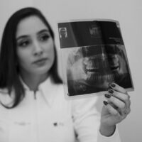 Zdjęcie panoramiczne zębów- wskazania